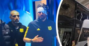 Marseille - Lyon postponed after OM fans attack on Lyon bus